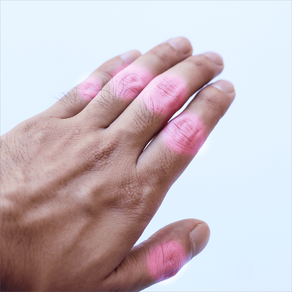 Anti-inflammatory meal beneficial for managing arthritis.