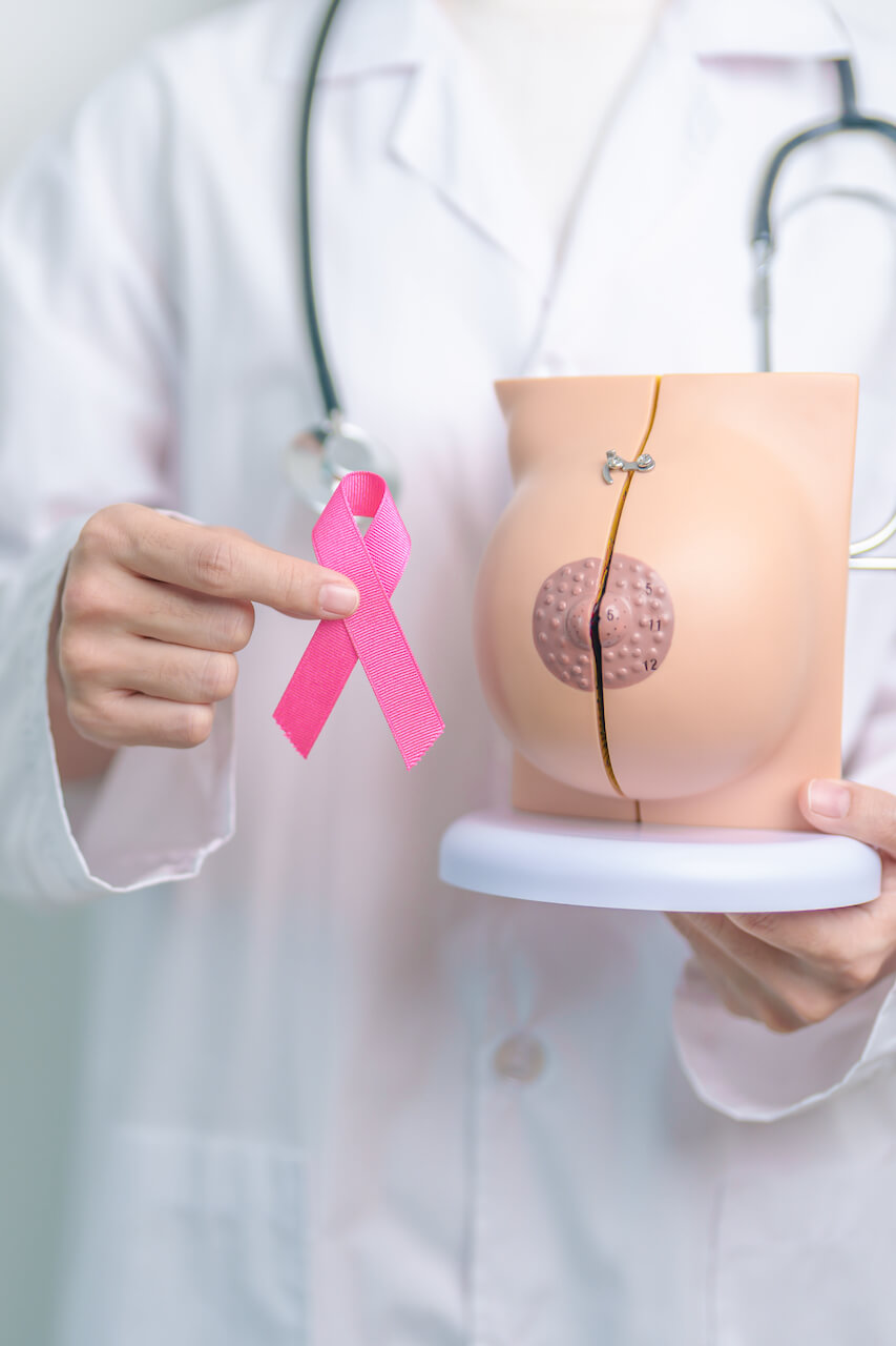 Doctor holding a breast model for educational purposes